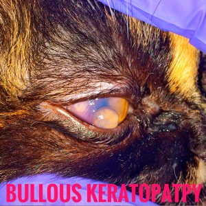 bullyoznaya-keratopatiya-300x300 Общая информация по офтальмологии