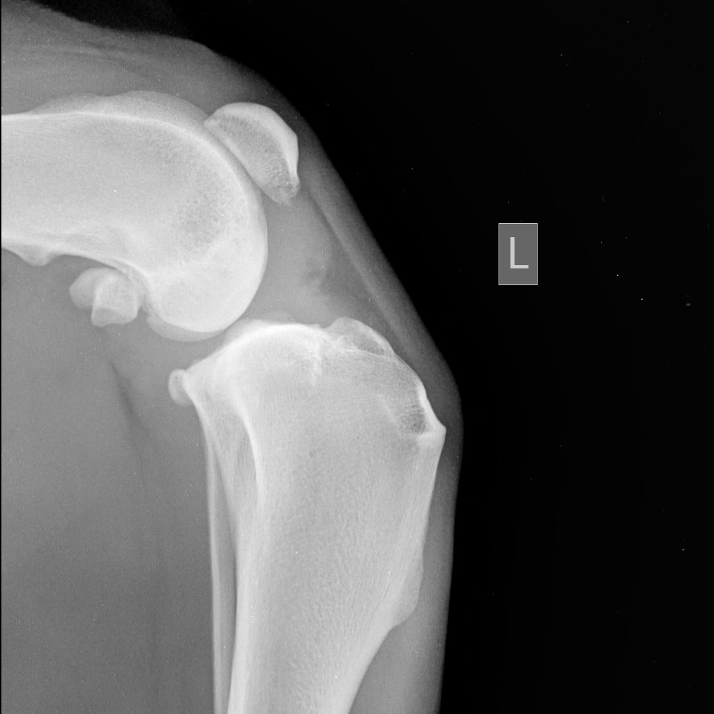 Разрыв связки у собаки. ПКС коленного сустава у собак. Рентген коленного сустава ПКС. Рентген коленного сустава собаки норма.