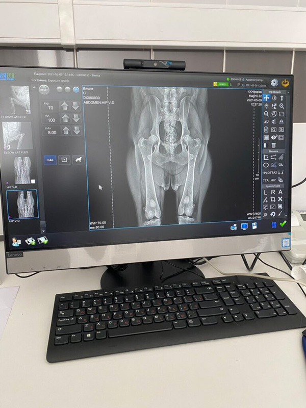 rentgenodiagnostika Общая информация по рентгенодиагностике