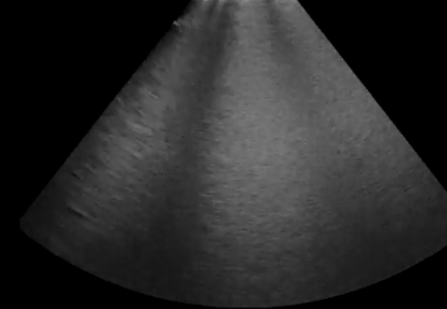 image003 УЗ-исследование органов грудной полости