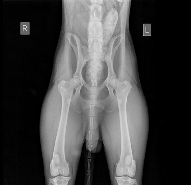 Рентген коленного сустава (колена)