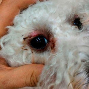asepticheskiy-granulematoznyy-blefarit-300x300 Общая информация по офтальмологии