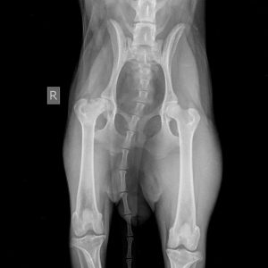 osteoartrit-tazobedrennogo-sustava-300x300 Резекционная артропластика ТБС