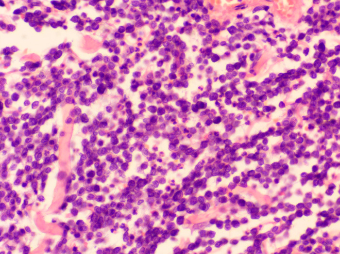 diagnostika-i-lechenie-mastocitomy-sobak-i-koshek Диагностика и лечение мастоцитомы собак и кошек