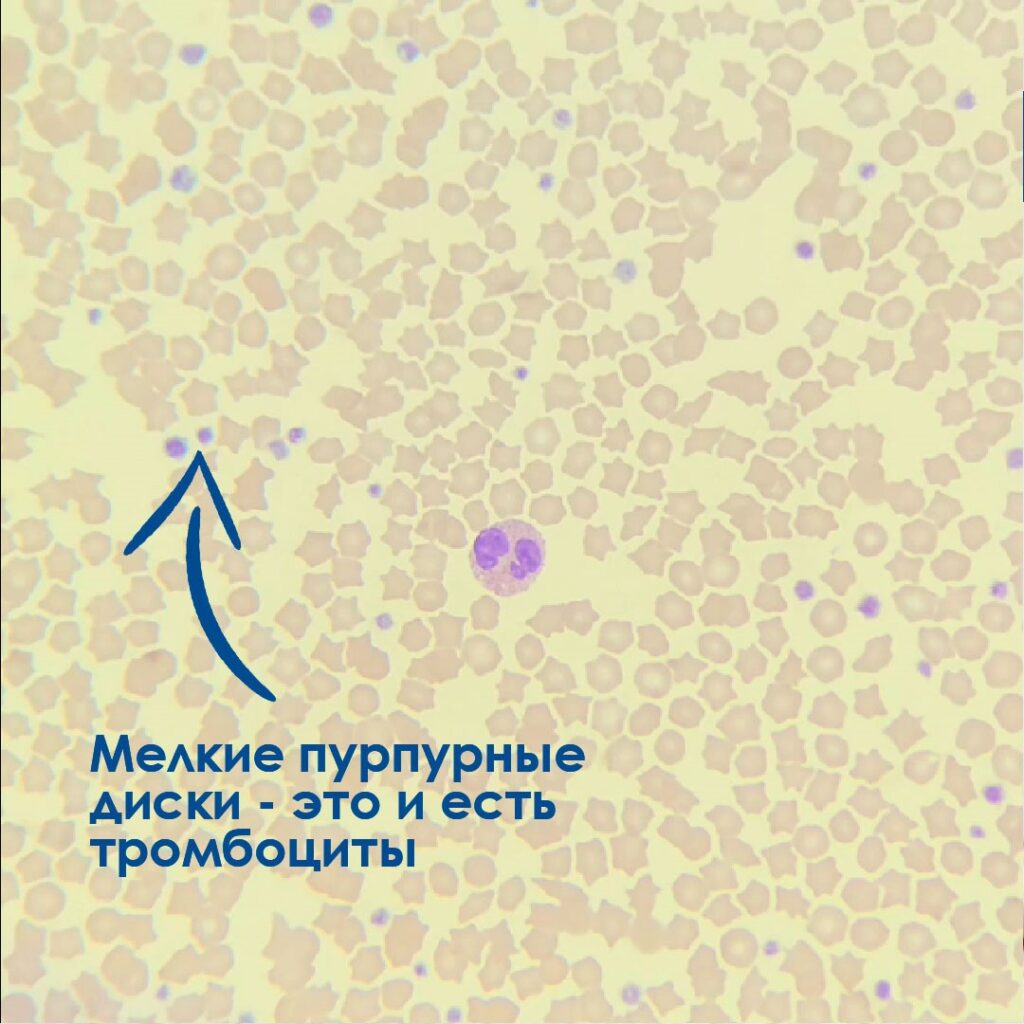 12-1024x1024 Что такое тромбоциты?
